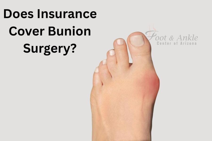 Cost of Bunion Surgery and Insurance Coverage Varies Widely